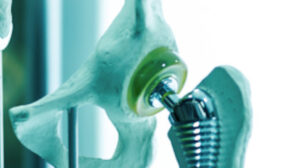 Titanium Medical Industry